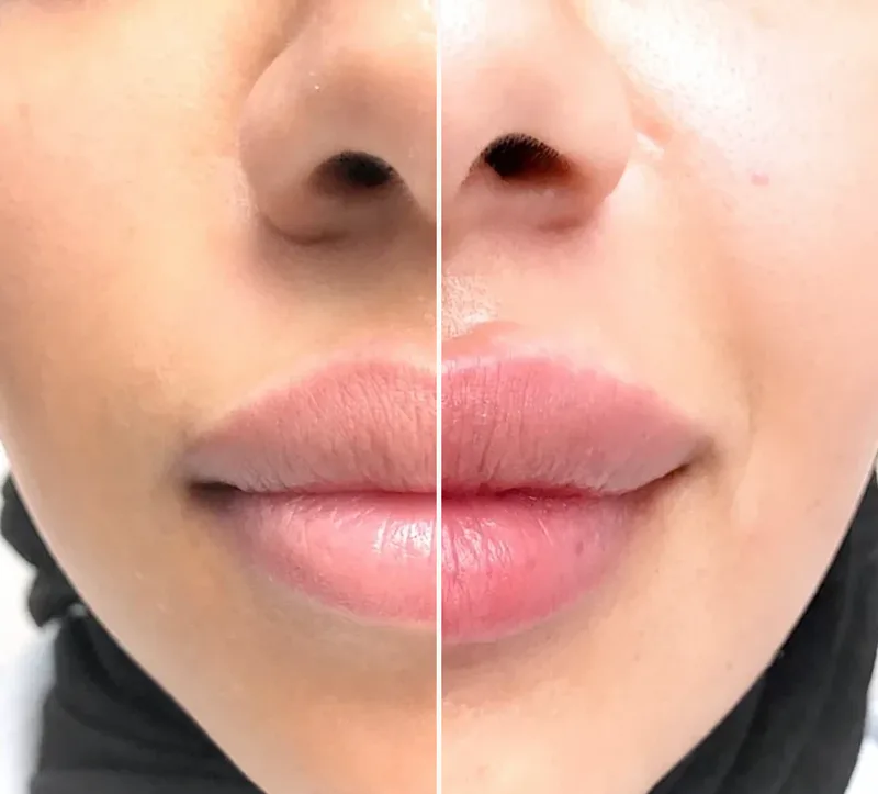 Juicy Lips