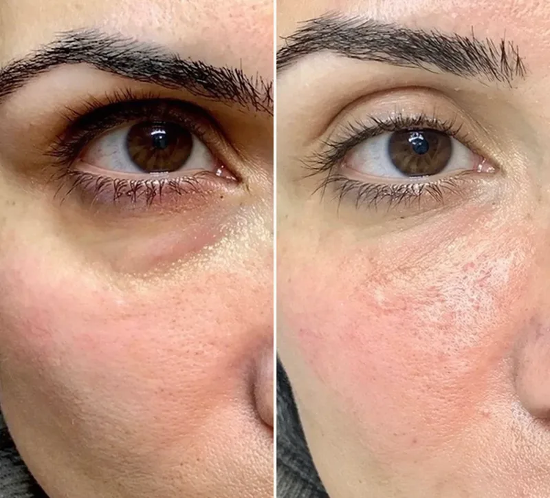 Real Results: Before & After