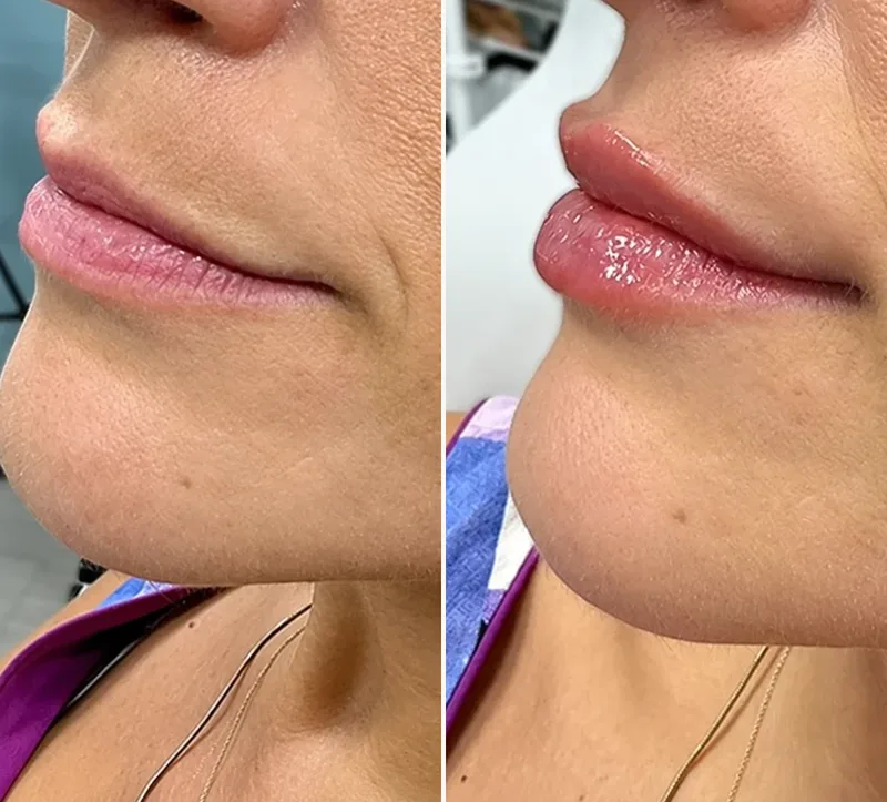 Natural Looking Lips