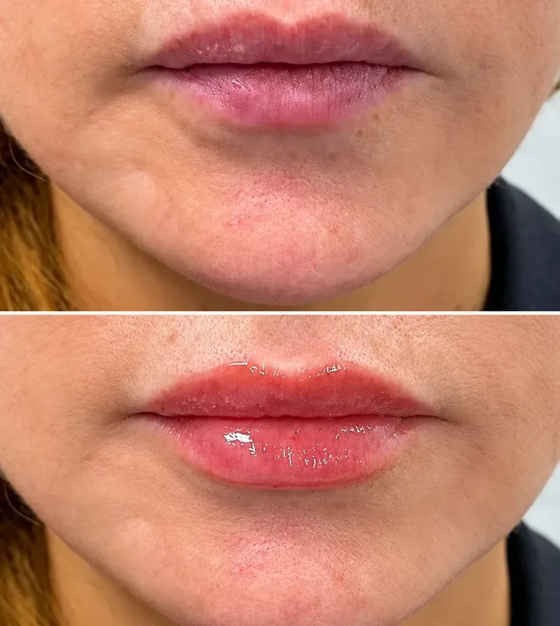 Real Results Lips