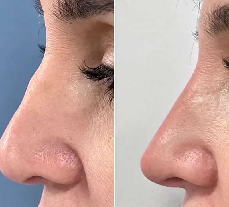 Real Results: Before & After