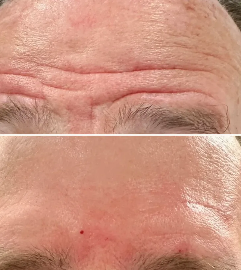 Real Results: Before & After